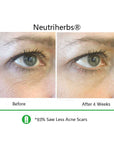 best-anti-aging-eye-gel-eye-gel-reviews-before-and-after