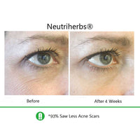 best-anti-aging-eye-gel-eye-gel-reviews-before-and-after
