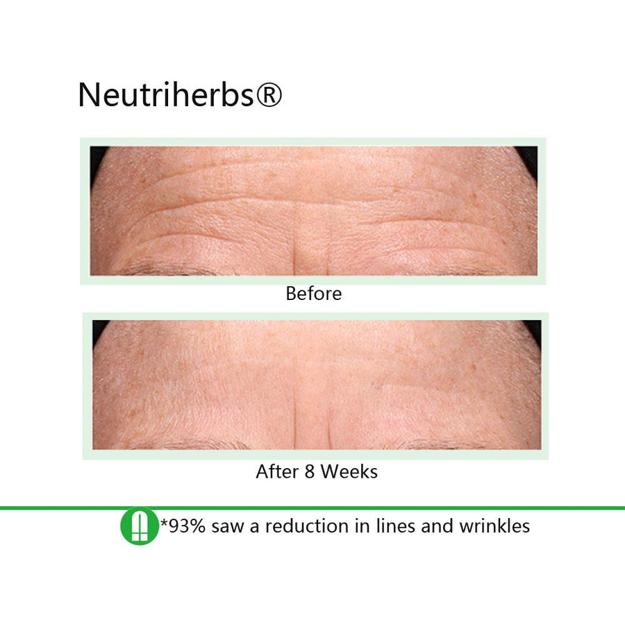 retinol-night-cream-retinol-cream-review-retinol-cream-before-and-after_1024x1024