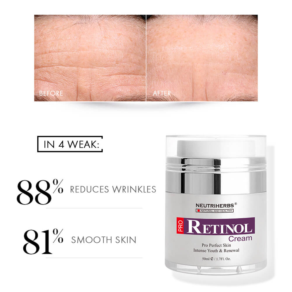 Crema Neutriherbs® Pro-Retinol para arrugas y marcas de acné